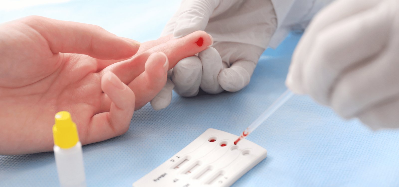 Cientistas alemães descobrem anticorpo que neutraliza 98% das variantes do HIV