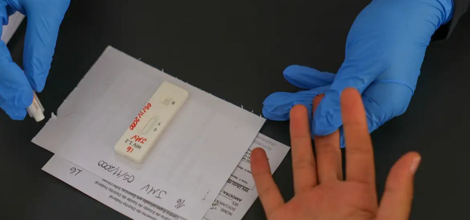 Brasil reduz mortes por aids ao menor nível em 30 anos, aponta Boletim Epidemiológico