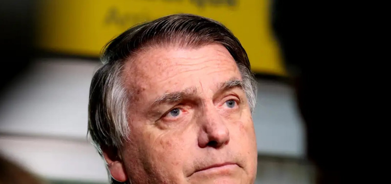 Agentes da PF monitoram Bolsonaro em internação antes da cirurgia