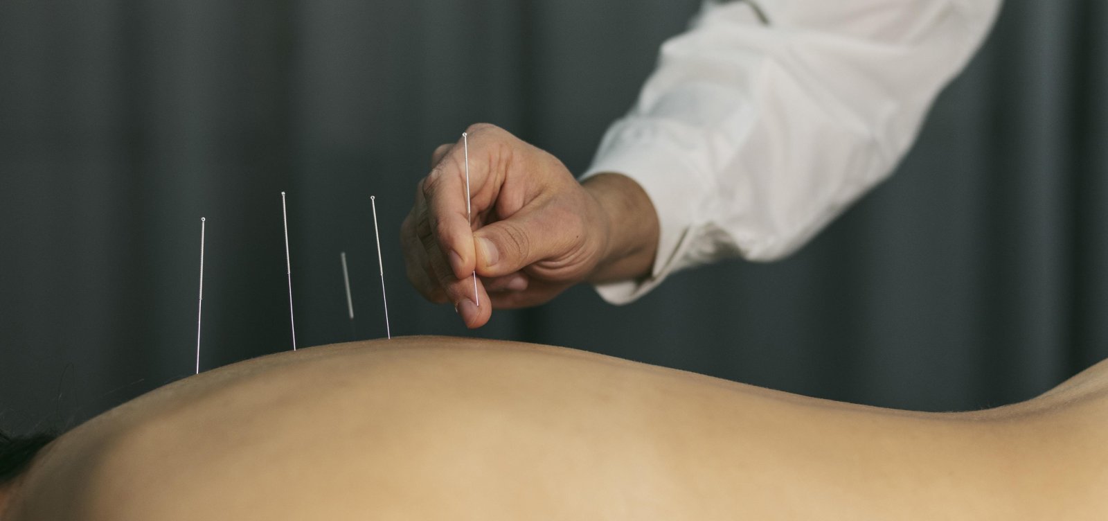 Governo federal regulamenta atuação profissional da acupuntura no Brasil