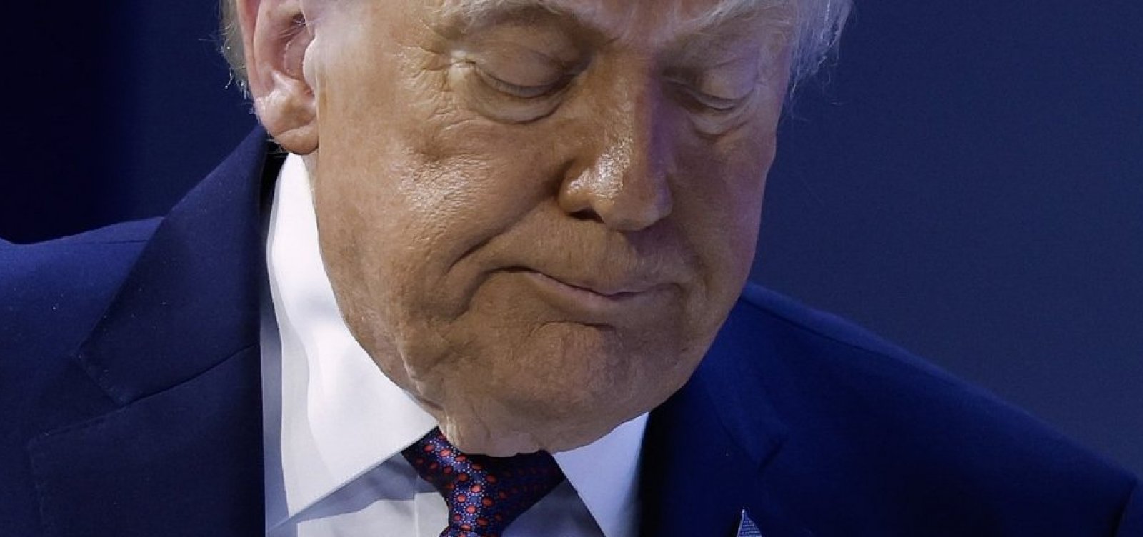 Hematomas na mão de Trump voltam a chamar atenção em reunião na Suíça