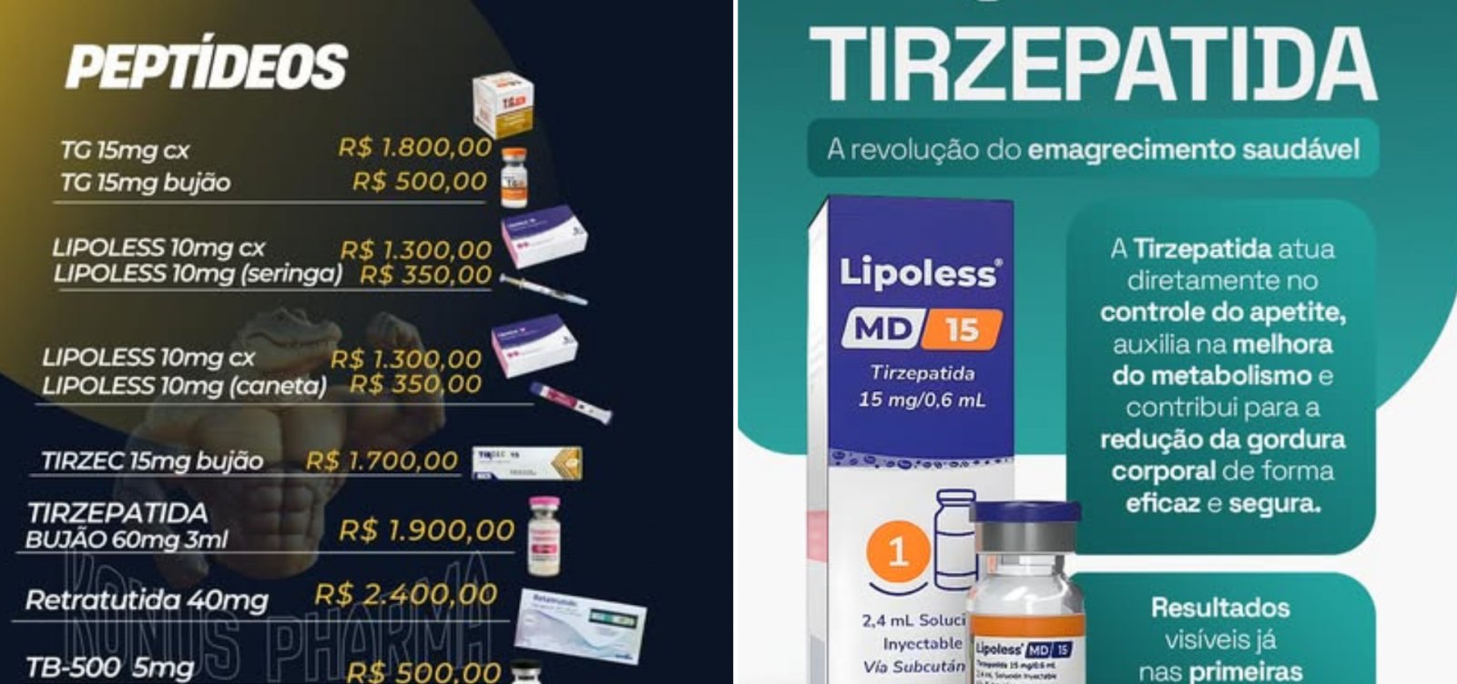 Cilada paraguaia: canetas emagrecedoras ilegais se espalham nas redes e já levam pacientes à UTI