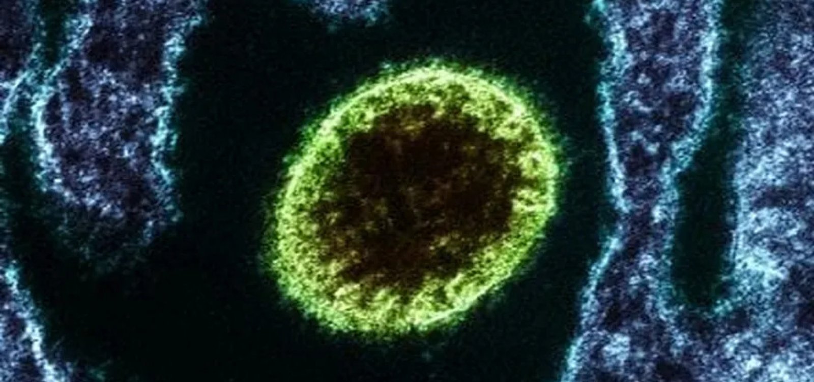 Vírus Nipah pode chegar ao Brasil? Entenda o que dizem as autoridades