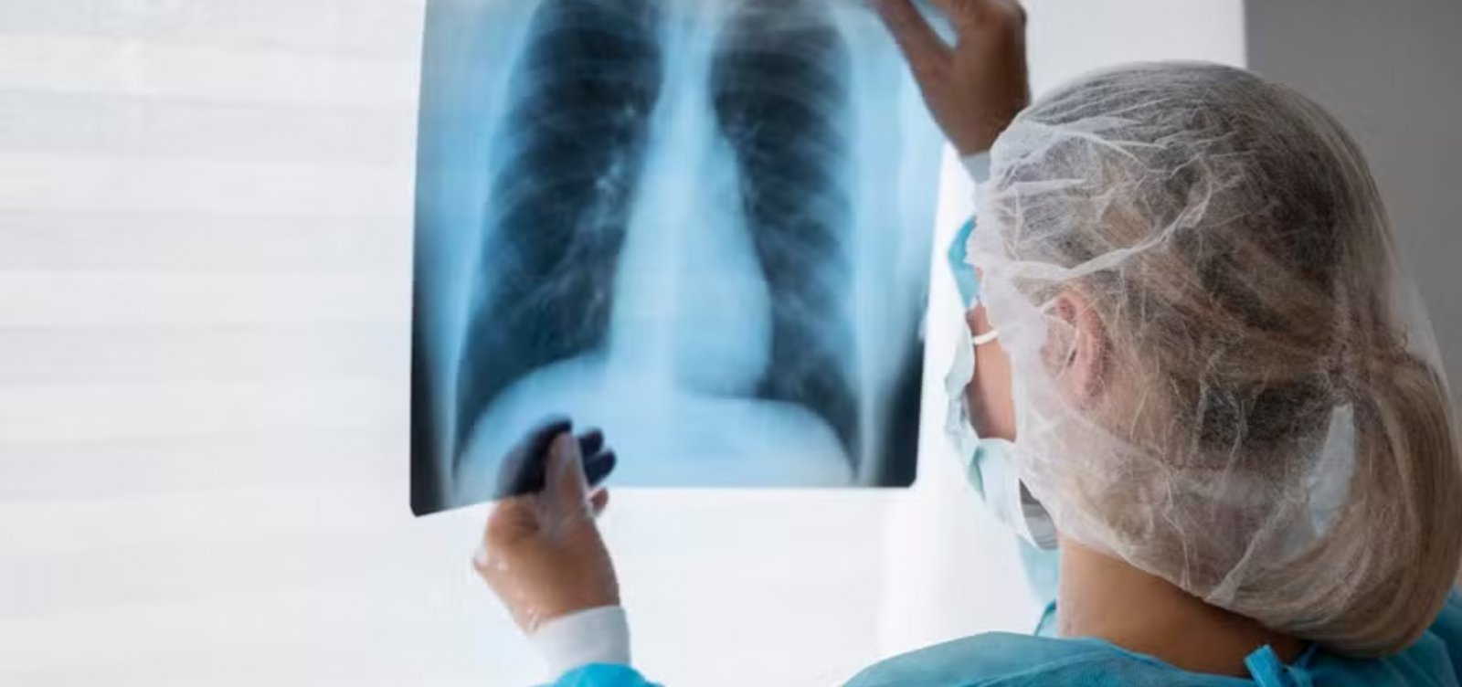 Inca inicia estudo para rastrear câncer de pulmão no SUS