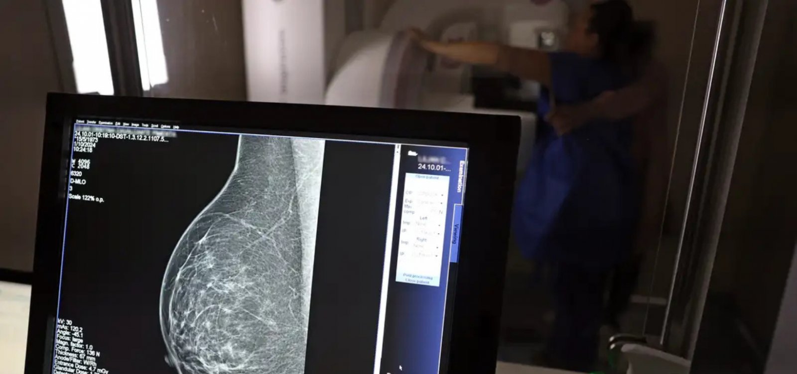 SUS vai oferecer teste genético para detectar risco de câncer de mama
