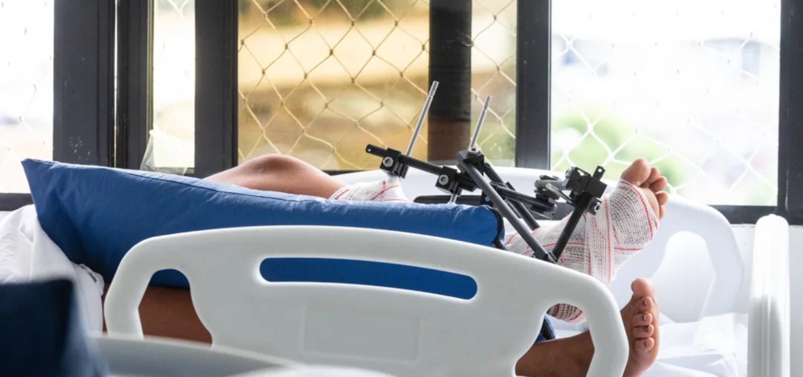 Bahia gastou quase R$ 150 milhões com acidentes de moto em 2025, diz Sesab 