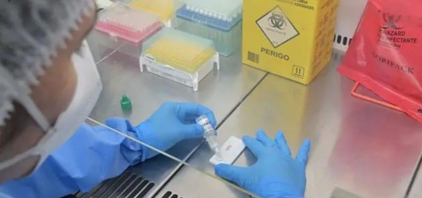Casos suspeitos de ebola no Brasil têm diagnósticos de meningite e malária, mas investigação continua