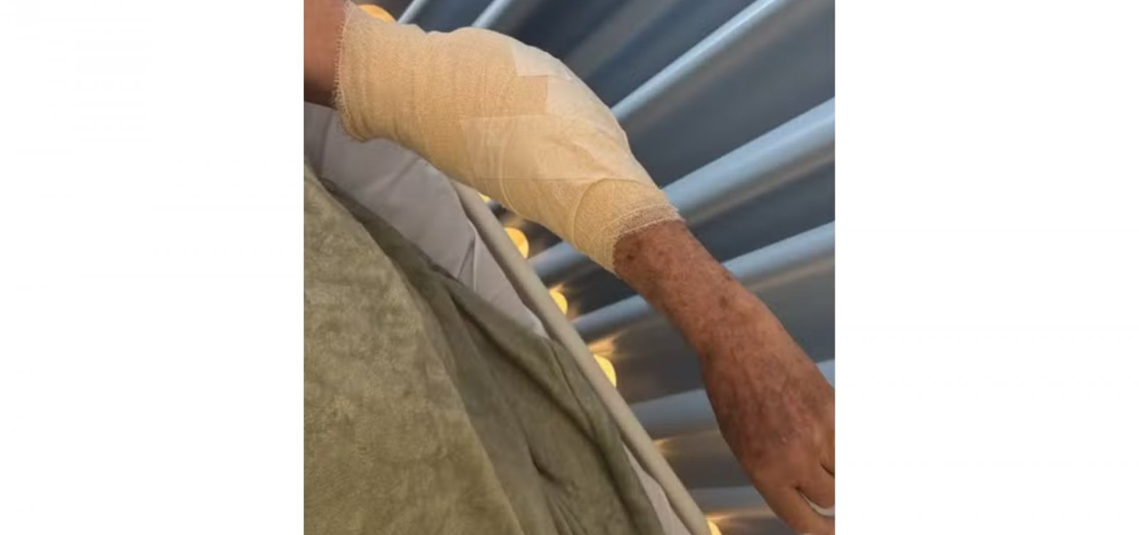 Idoso de quase 80 anos é atacado por pitbull na orla de Salvador