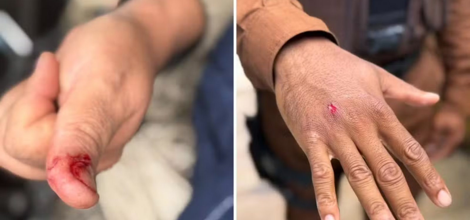 Macaco-prego invade casas, ingere álcool e medicamentos e deixa cinco feridos em Salvador