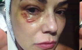 Empresário acusado de agredir Luiza Brunet volta a ser julgado nesta segunda