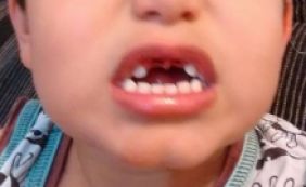 Criança de 4 anos presta depoimento após perder dois dentes na escola