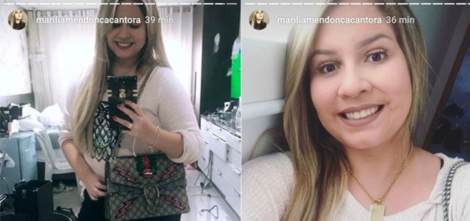 Marília Mendonça aparece 8kg mais magra e inicia tratamento antiflacidez
