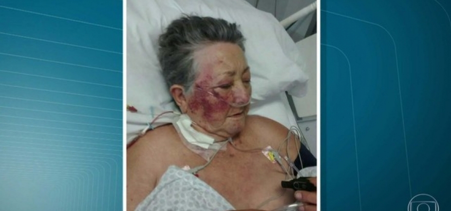 Absurdo! Idosa de 78 anos é agredida por enfermeiro na UTI