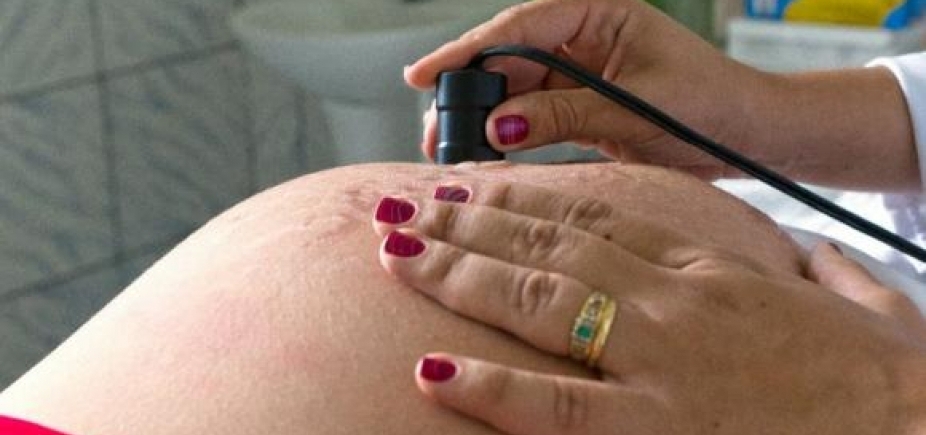Gravidez na adolescência cai 17%; Nordeste ainda lidera lista