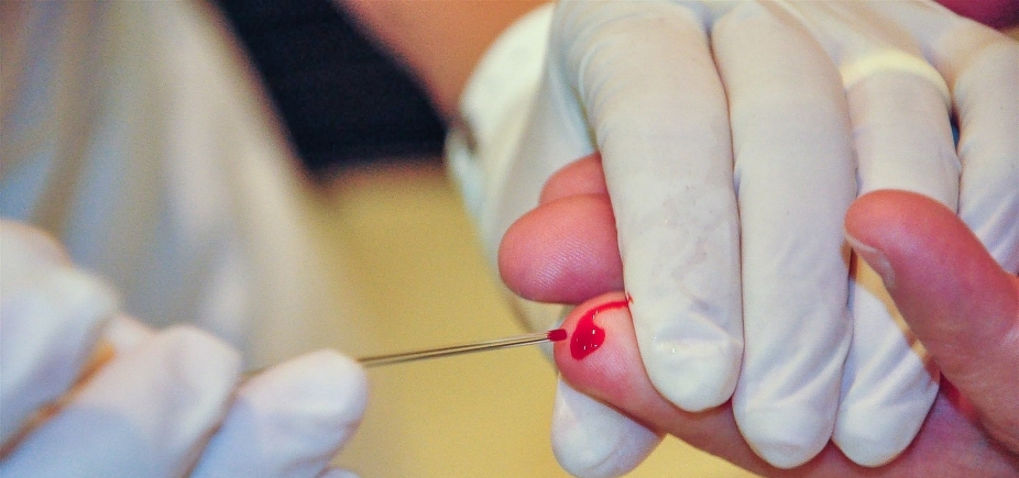 Postos de saúde realizam testes rápidos para diagnóstico precoce de hepatites virais durante o mês de julho