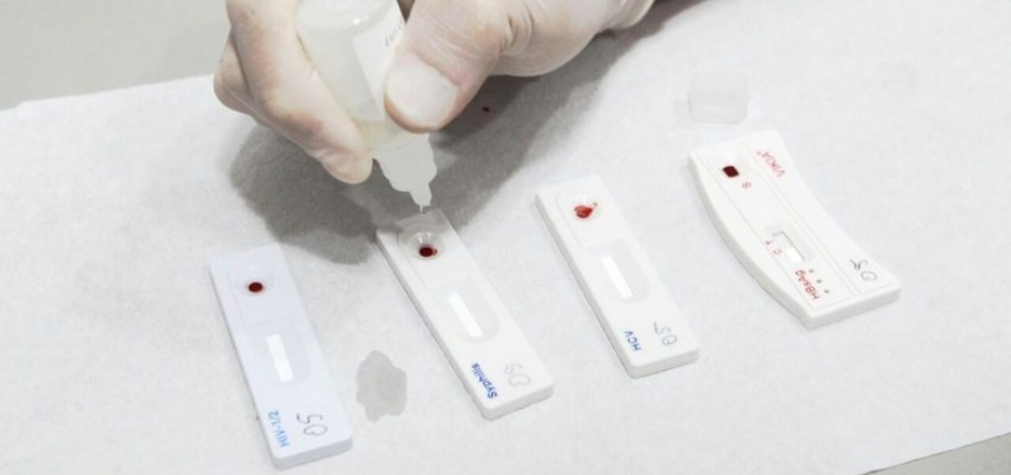 Autoteste de HIV estará disponível nacionalmente em farmácias até o fim de julho 