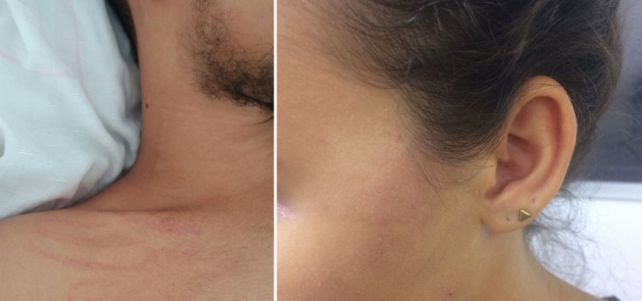 Casal presta queixa contra guardas municipais por suposta agressão