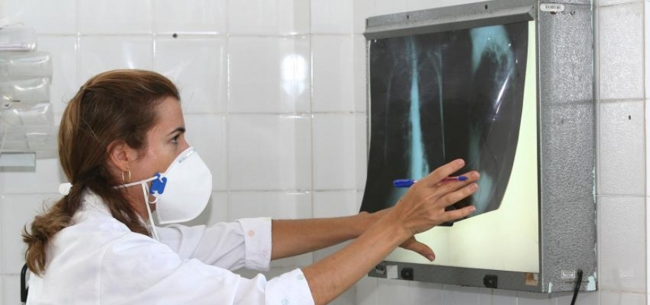 Bahia é o 2º estado do Nordeste com maior número de casos de tuberculose