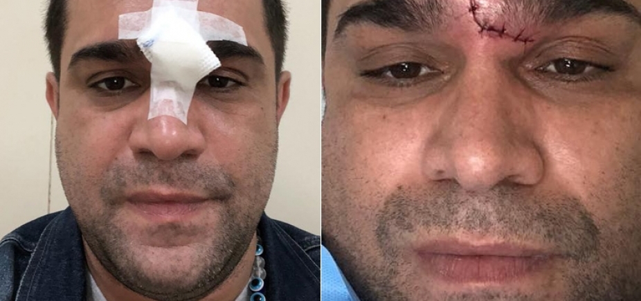 Humorista cai no banheiro e quebra a cara no box