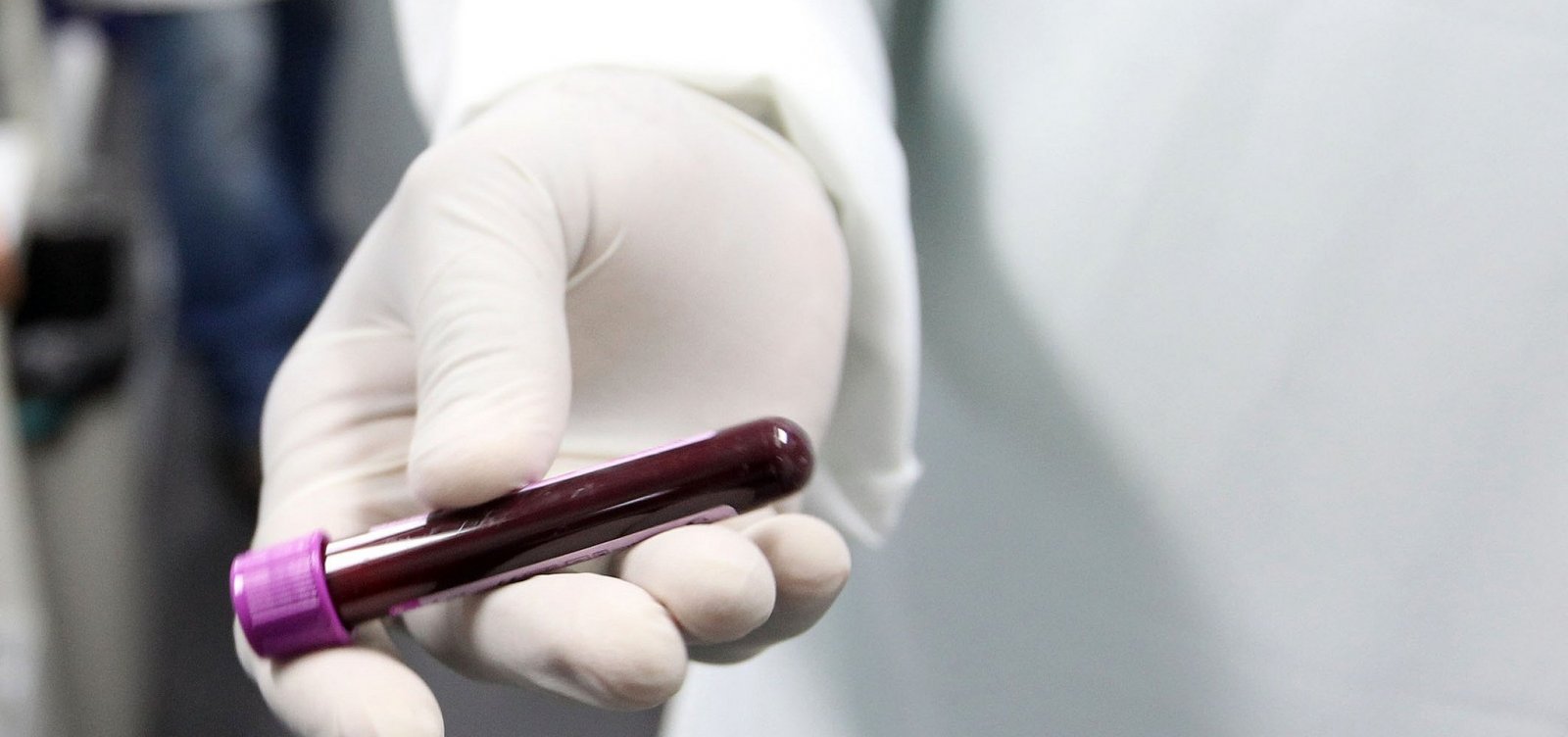 Apenas 1,6% da população brasileira doa sangue, revela ministério da Saúde