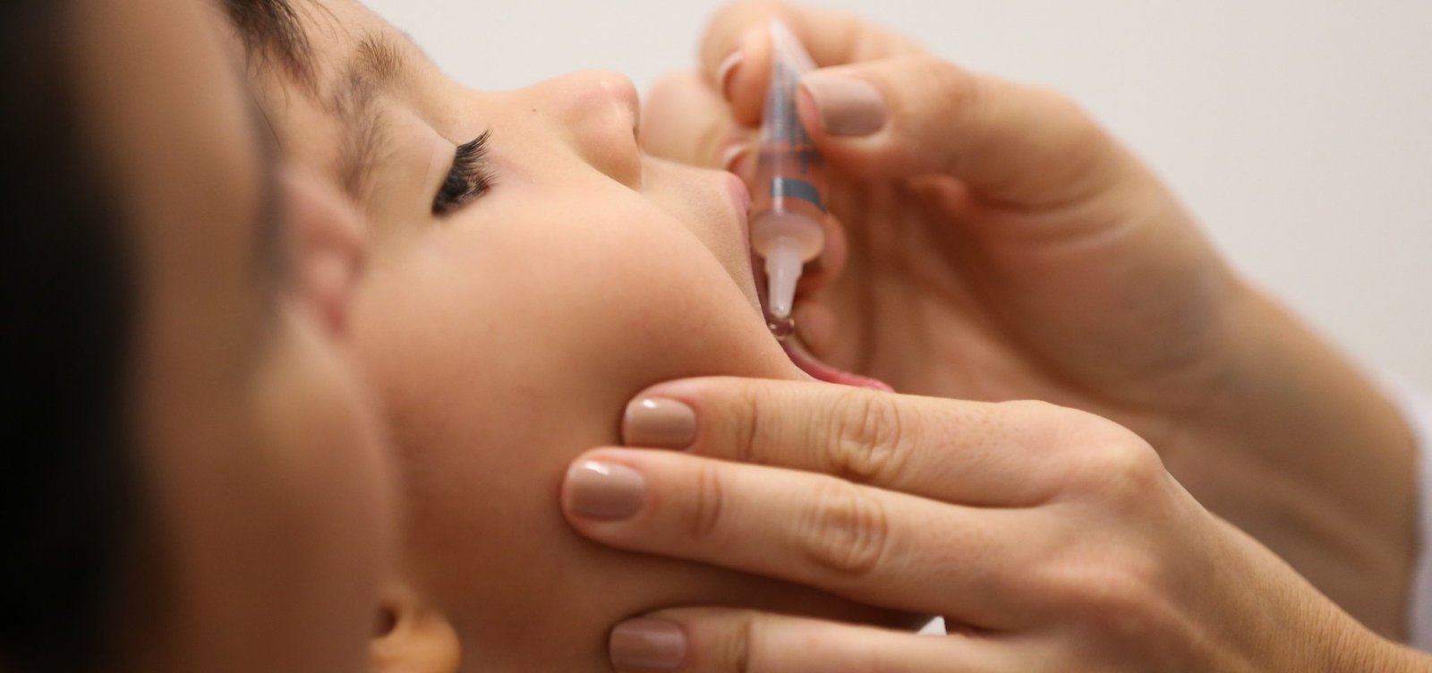 Surto de sarampo no Amazonas e em Roraima já registra 500 casos