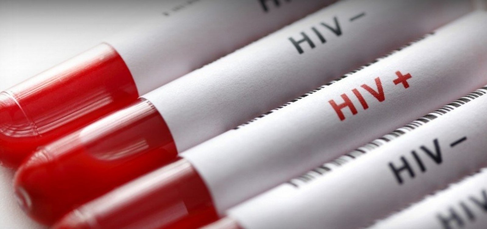 Nova vacina contra o vírus HIV apresenta bons resultados