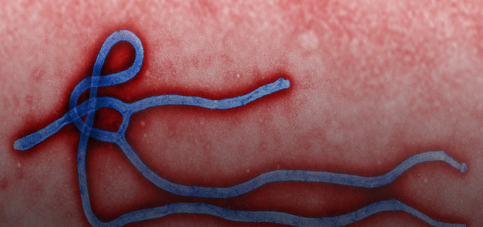 Sobreviventes do ebola criam anticorpos especiais contra o vírus