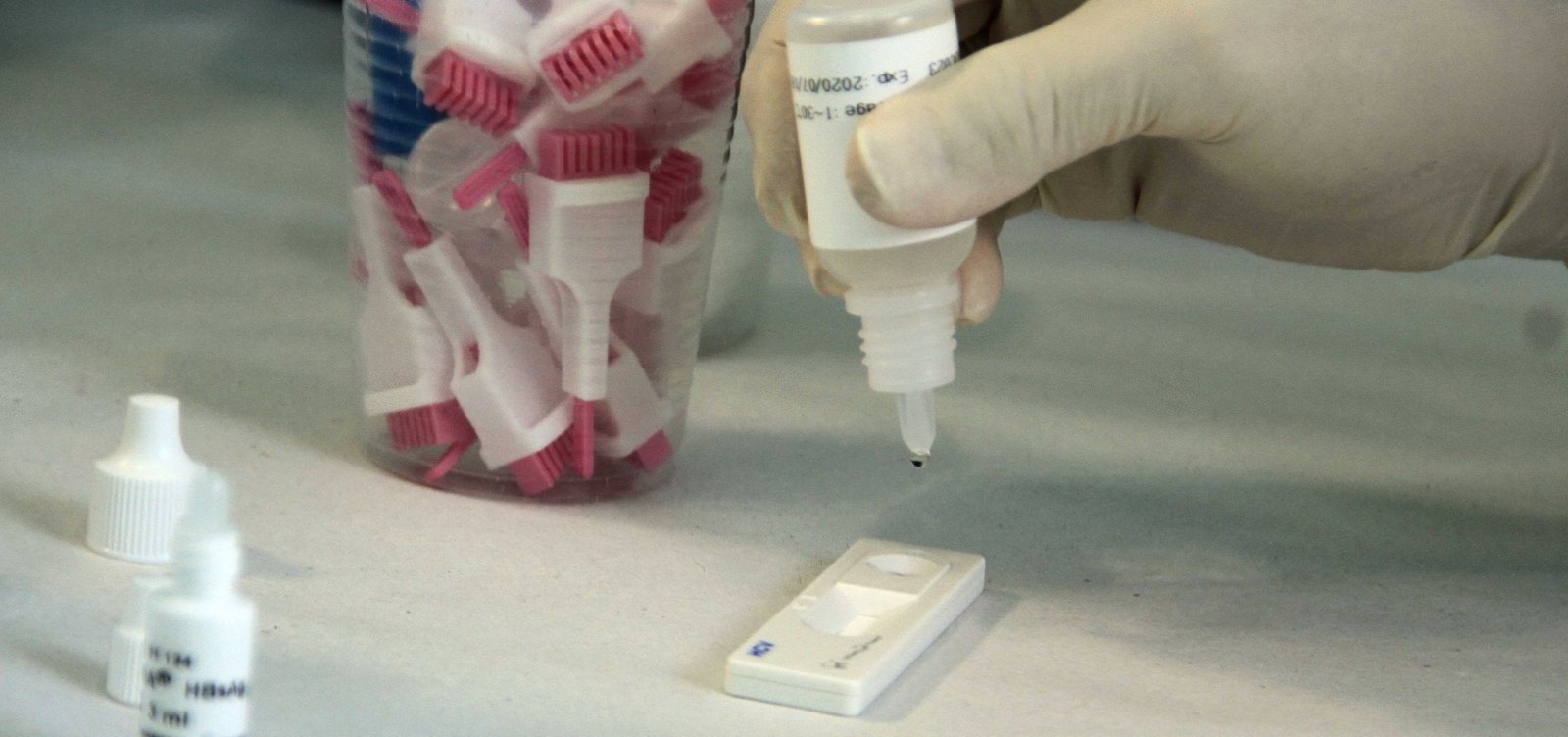 OMS pede urgência em testes e acesso a tratamento da Hepatite