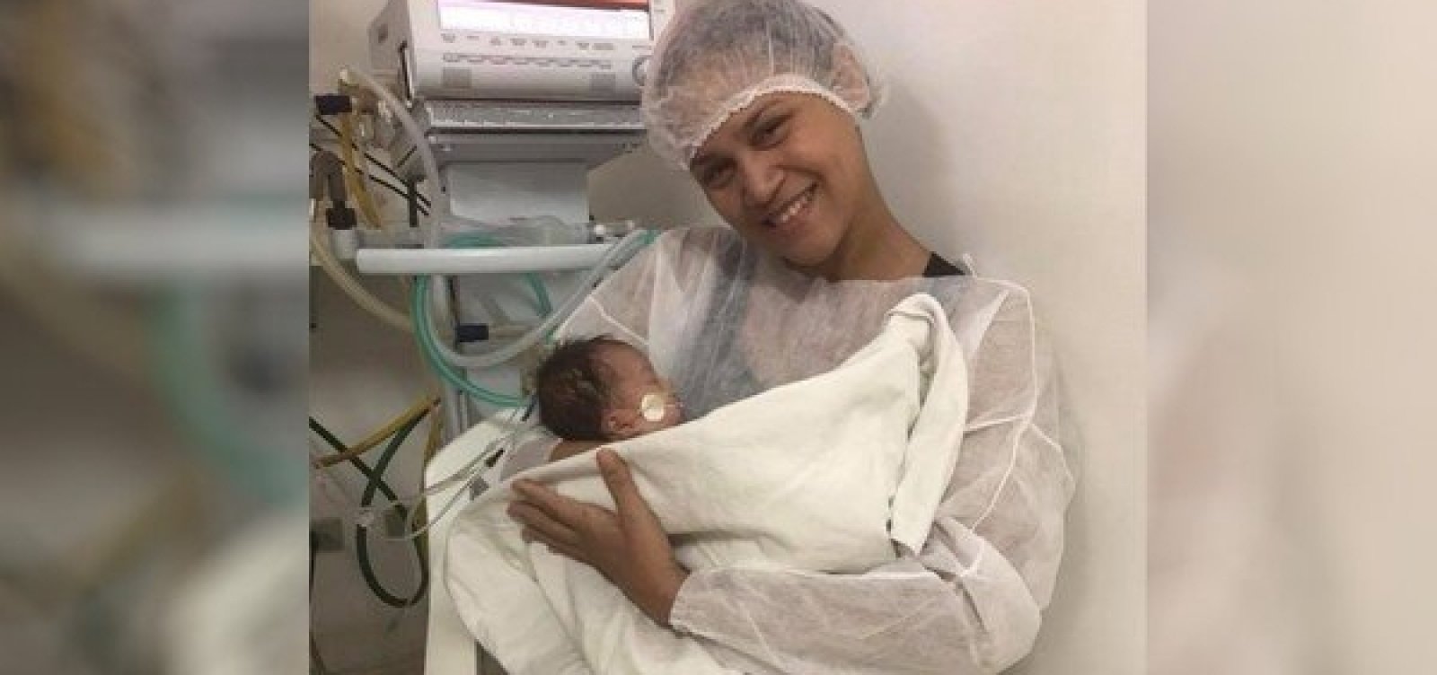Mãe de gêmeas siamesas é liberada para segurar uma das filhas no colo