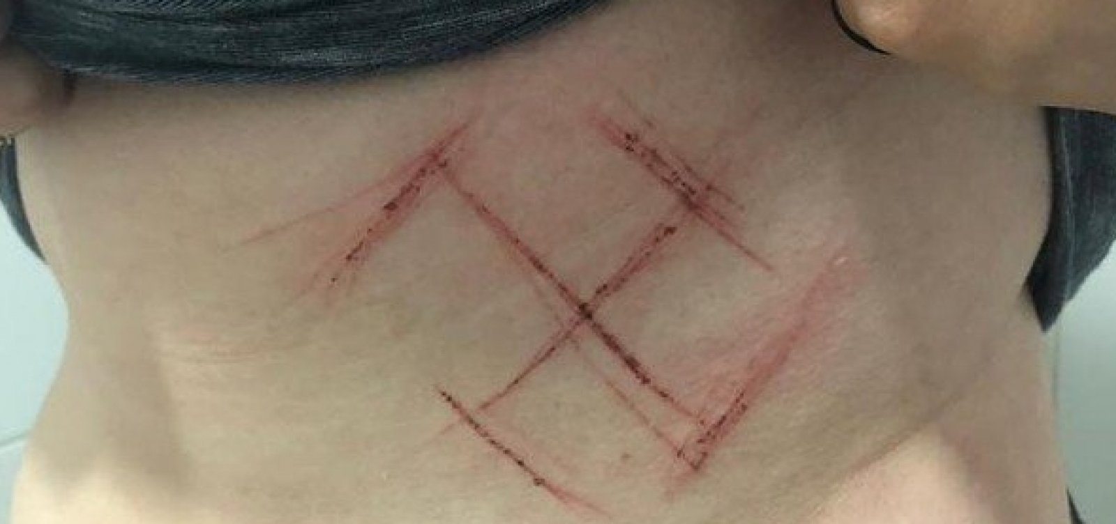 Jovem de 19 anos é agredida e marcada com canivete por vestir camiseta com “Ele Não”