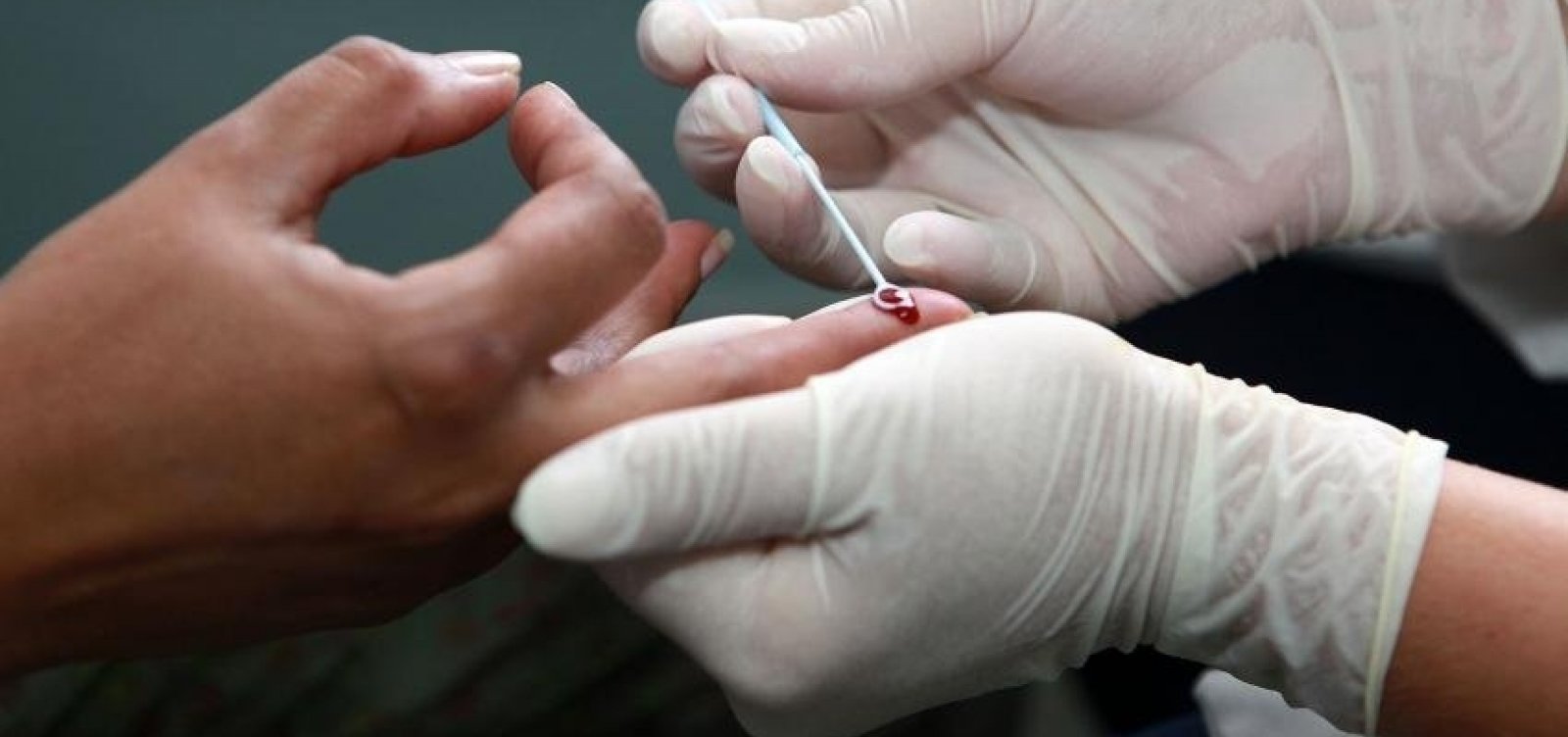 Número de detecções de Aids cai 16% no Brasil