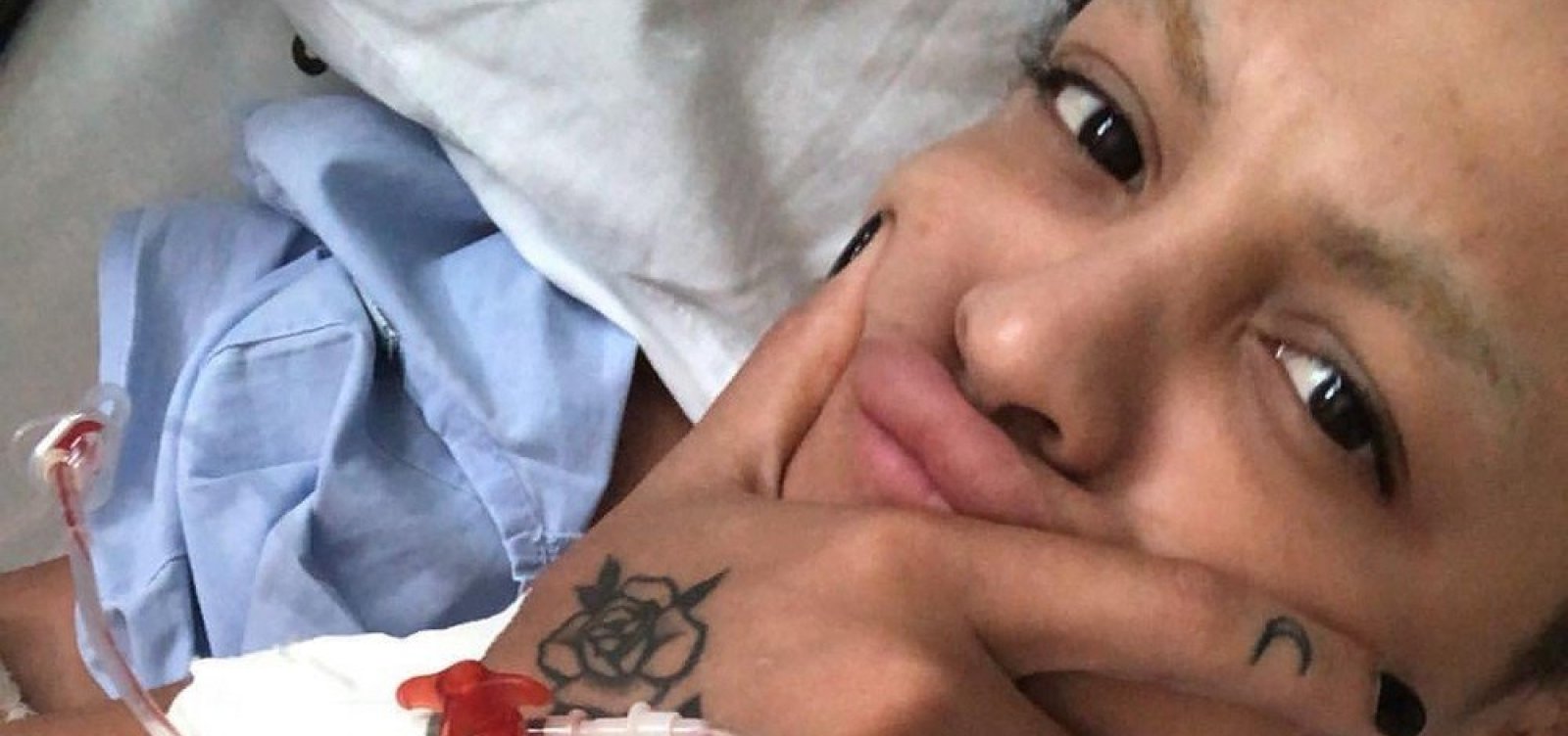 Pabllo Vittar passa por cirurgia no joelho: 'Fui abaixar para pegar um copo e só ouvi o estouro'