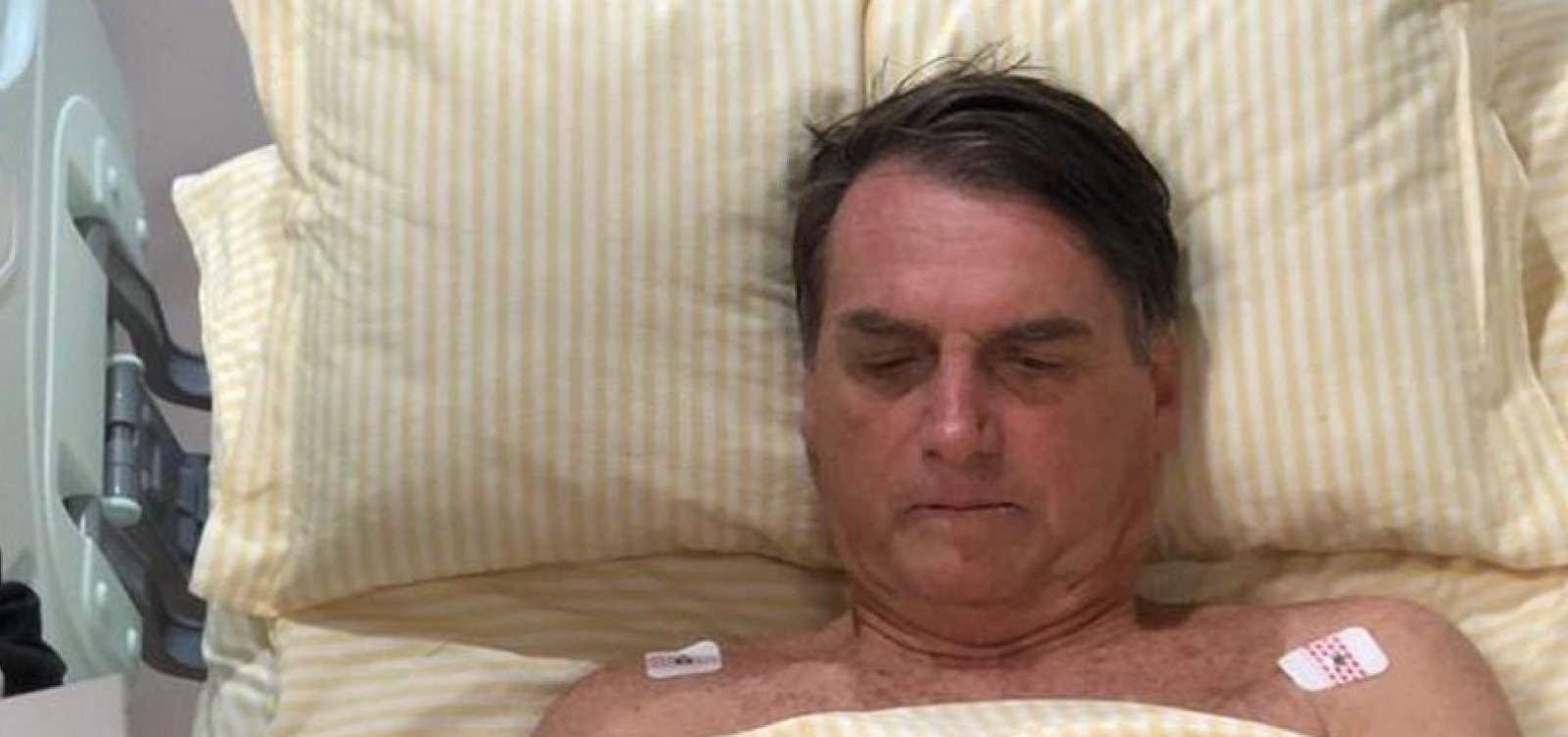 Bolsonaro tem quadro pulmonar 'em resolução' e não sente dor, diz boletim