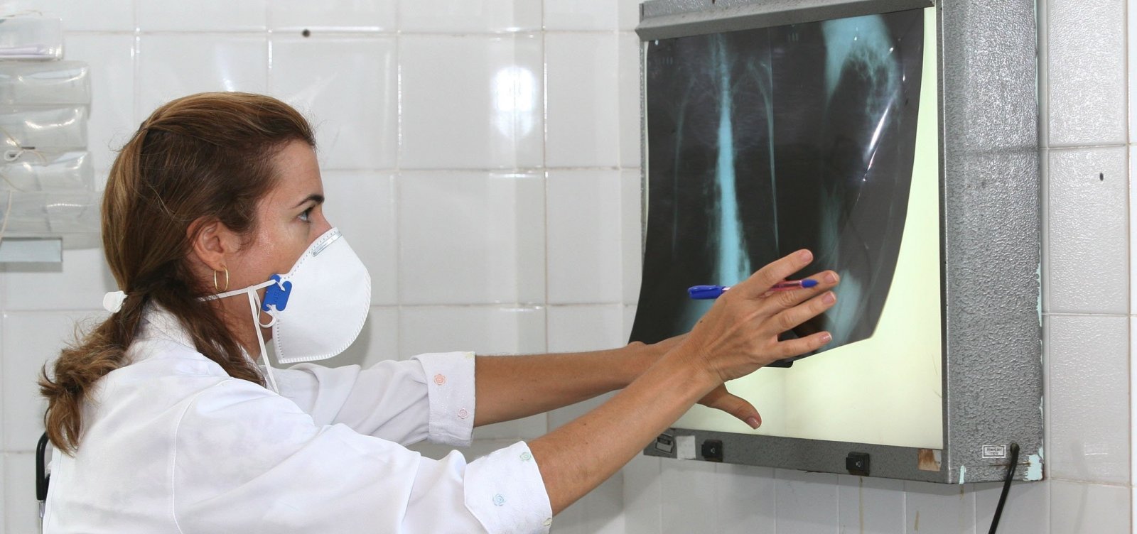 Fundação José Silveira promove mutirão de combate a tuberculose em São Cristóvão