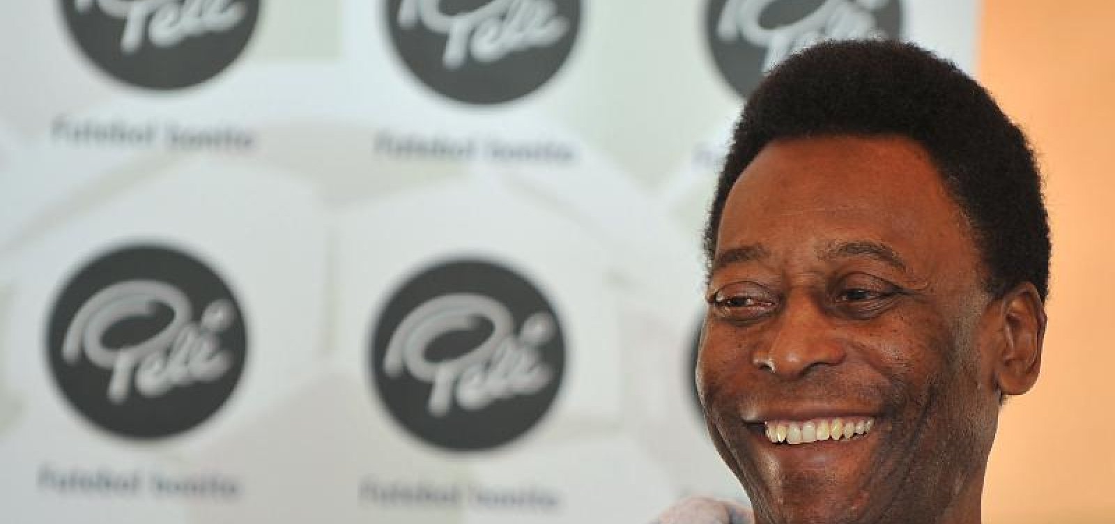 Médicos retiram cálculo renal e Pelé tem bom estado clínico