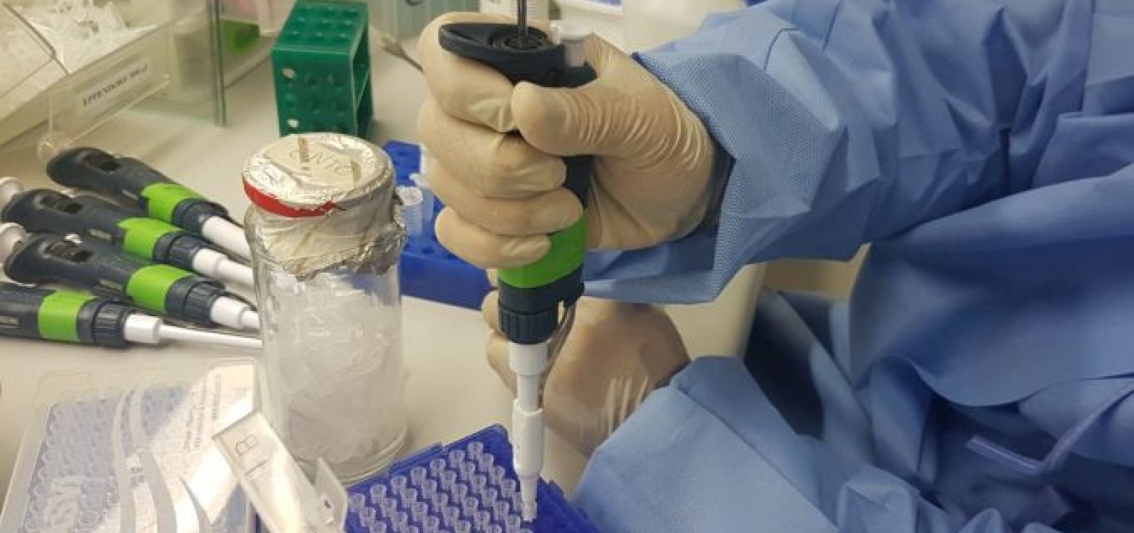 Fiocruz desenvolve teste para Zika com resultado em 20 minutos