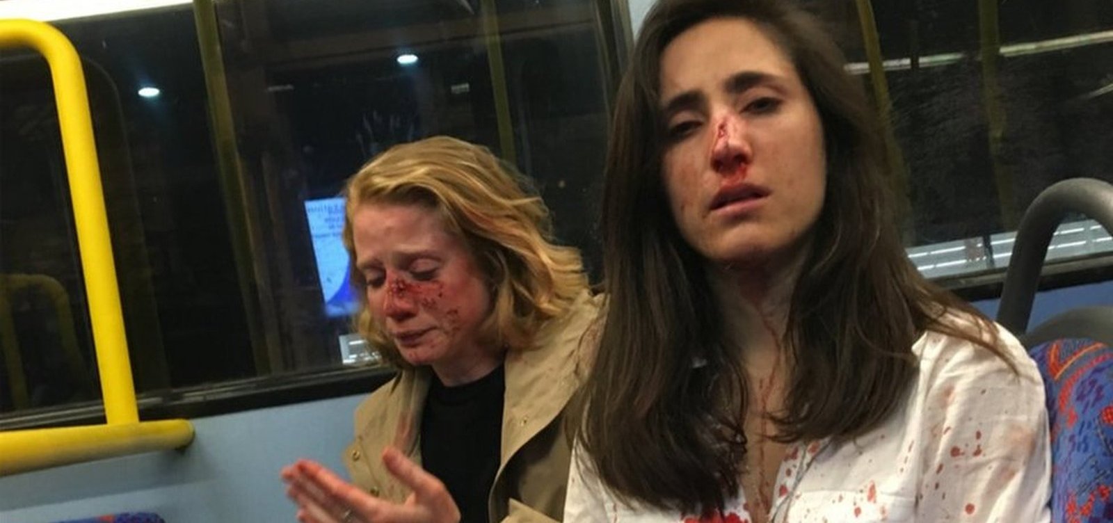 Após pagamento de fiança, detidos por agredir casal de lésbicas ganham liberdade