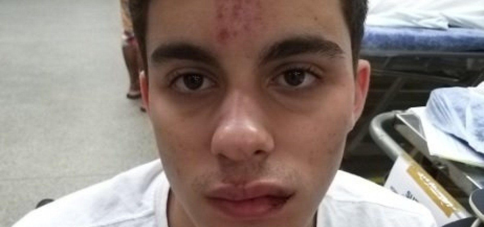 Estudante é agredido na saída da festa Hype em Ondina
