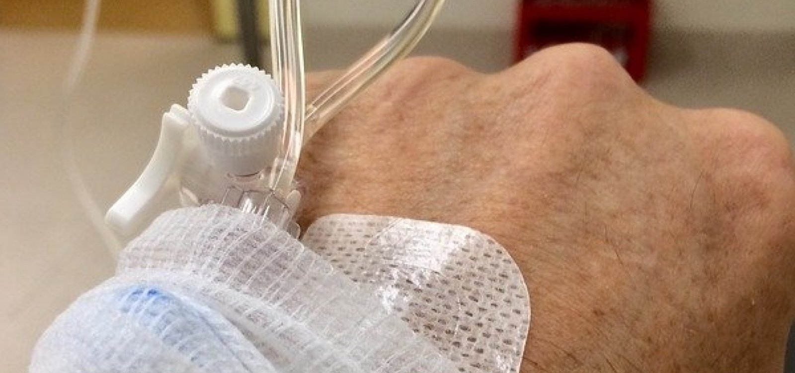 Projeto Fila Zero para pacientes com câncer no SUS é aprovado na AL-BA