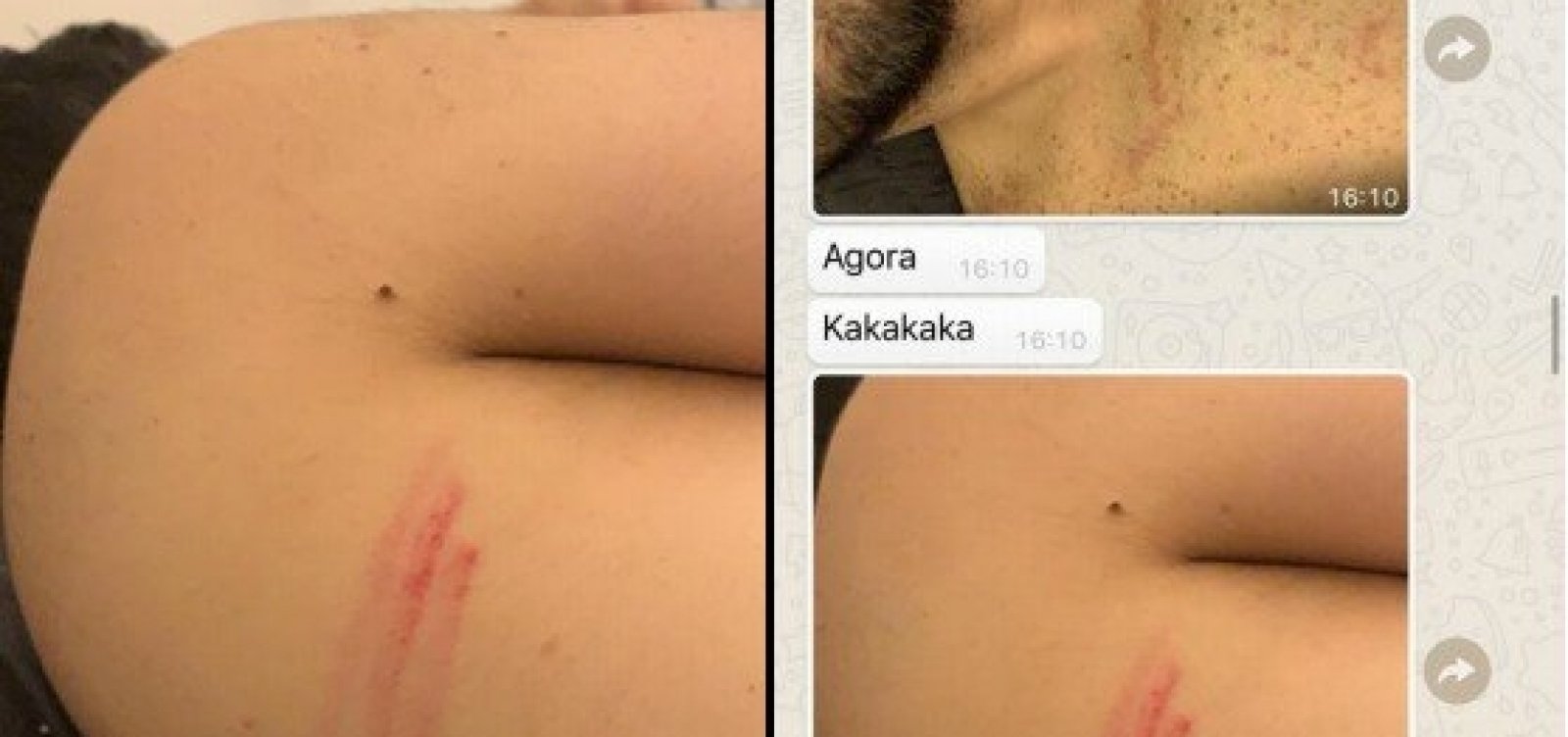 Caso Marcell: deputado enviou fotos com marcas de agressão para primo