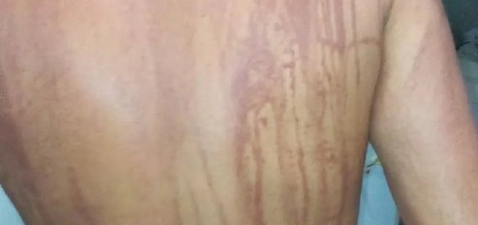 Ilhéus: secretaria descarta intoxicação por óleo em turista de MG 