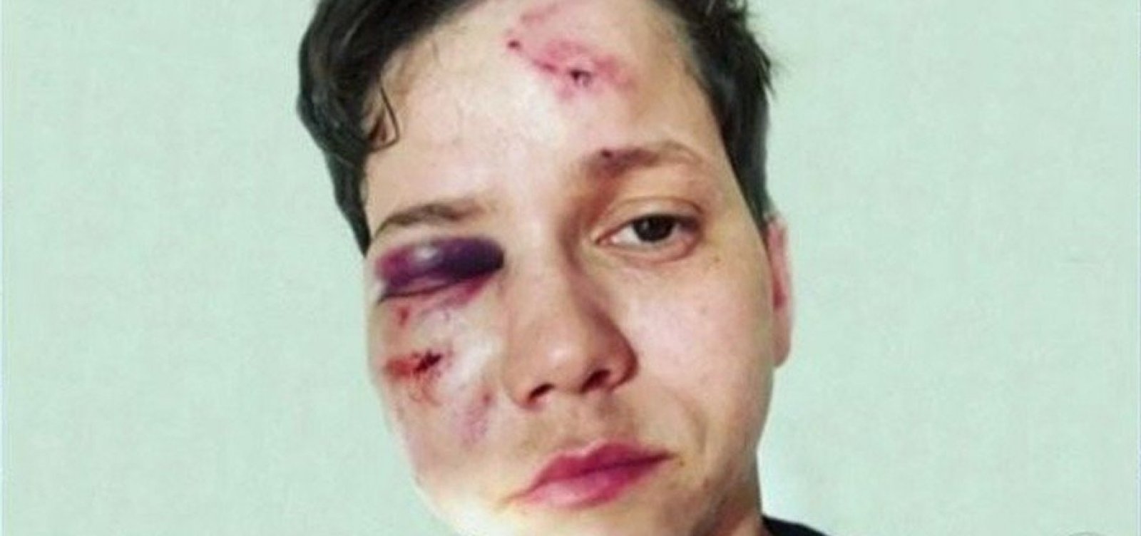 Polícia conclui que Karol Eller mentiu em depoimento e caso de agressão não foi homofobia