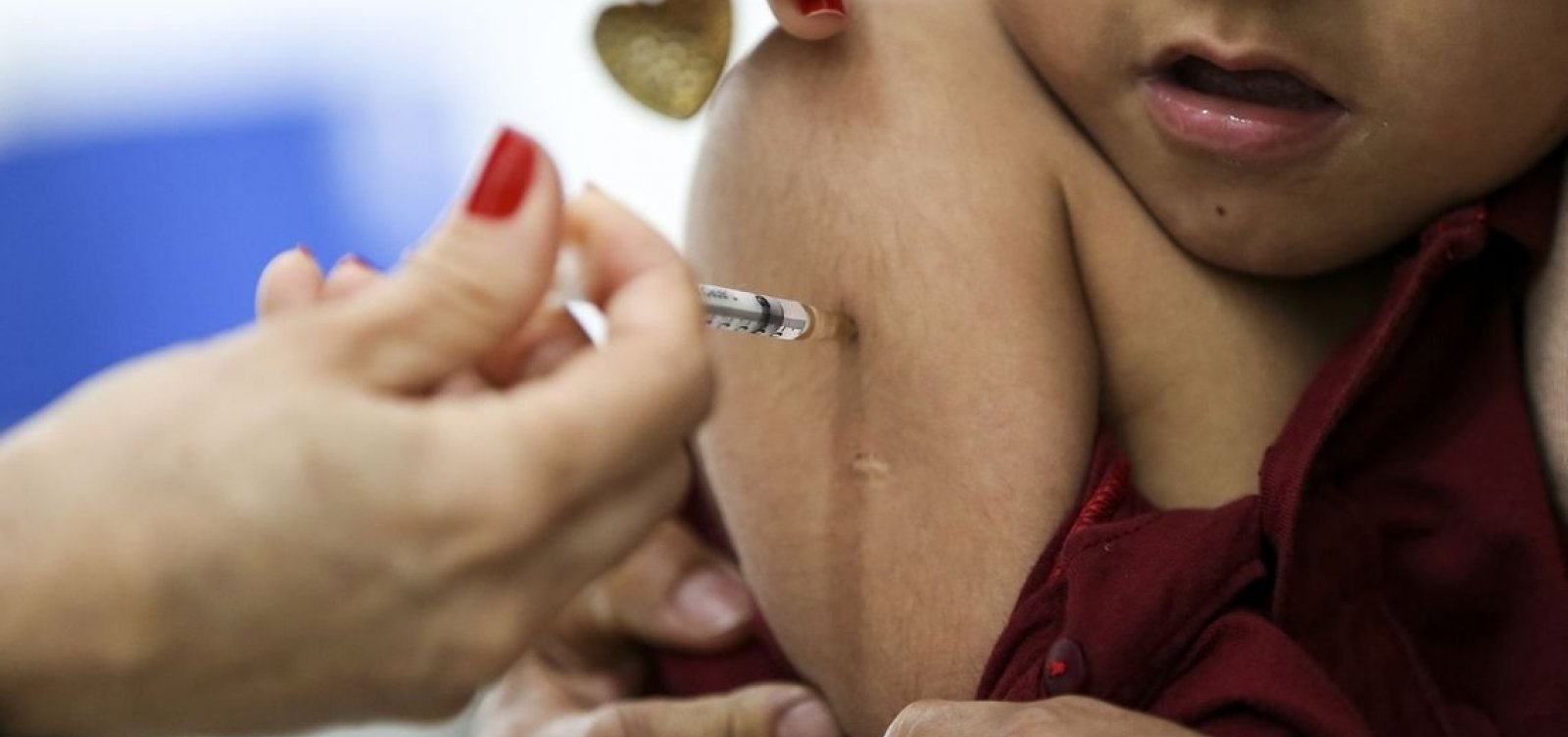 Começa na segunda campanha de vacinação contra o sarampo na Bahia