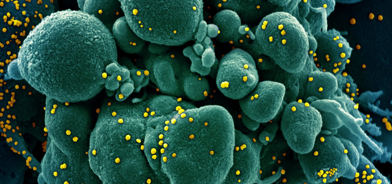 Petrópolis, no Rio de Janeiro, tem primeira vítima fatal do novo coronavírus