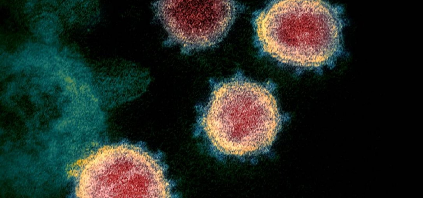 Sobre para 3.477 número de casos confirmados do novo coronavírus no Brasil; mortes são 93