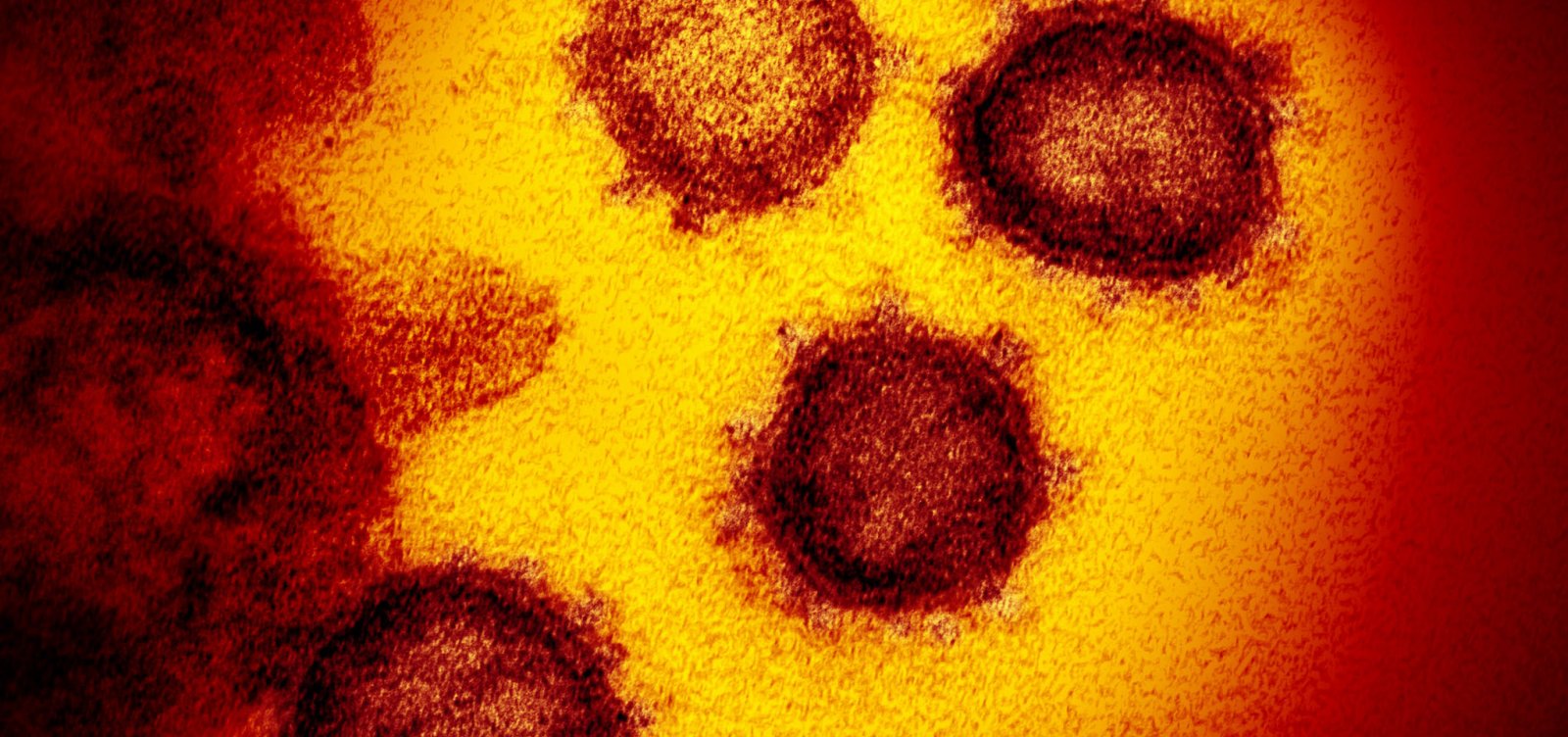 Rio Grande do Sul começa 1º grande teste para saber nº de infectados pelo coronavírus
