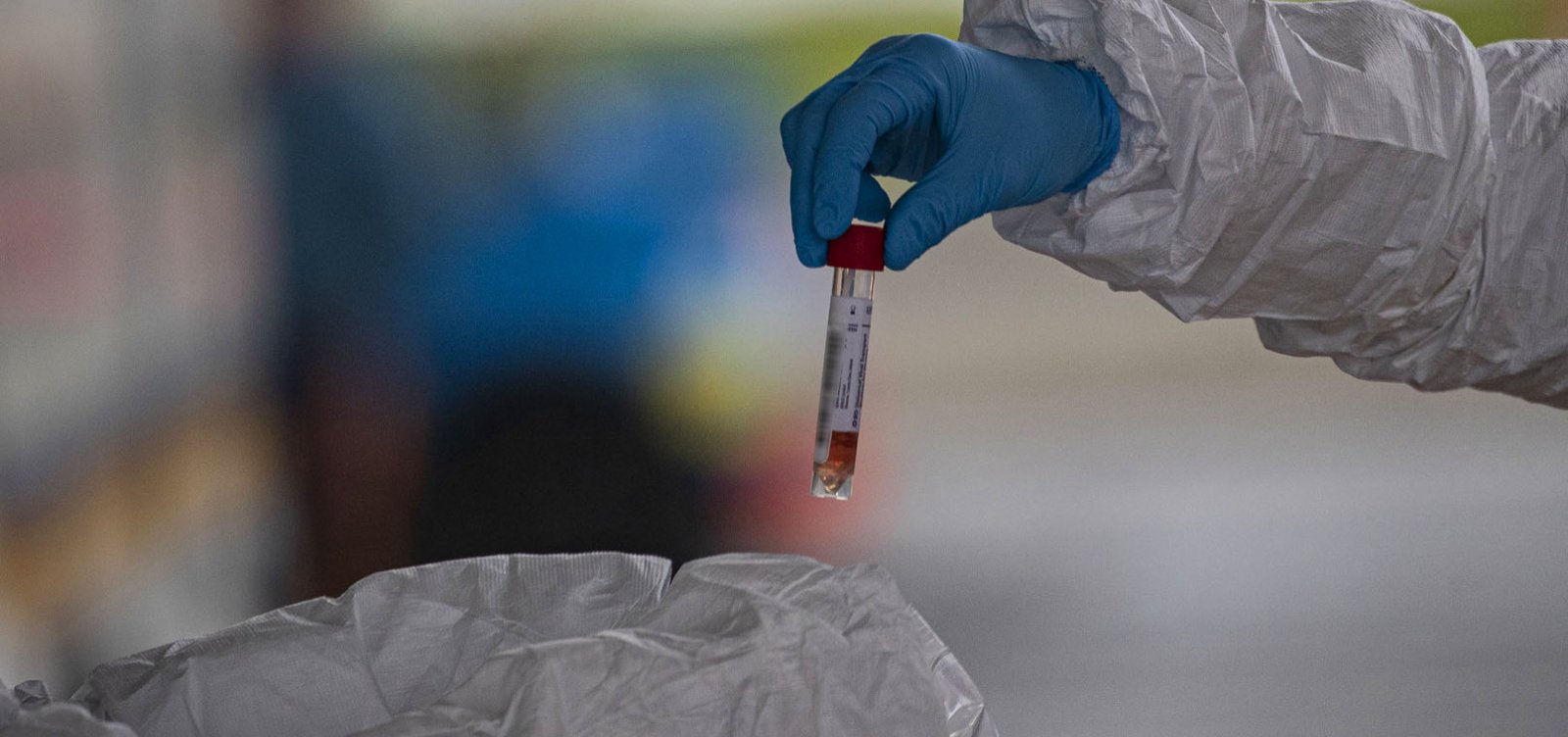 Brasil fará testes em massa neste mês para saber número de infectados por coronavírus