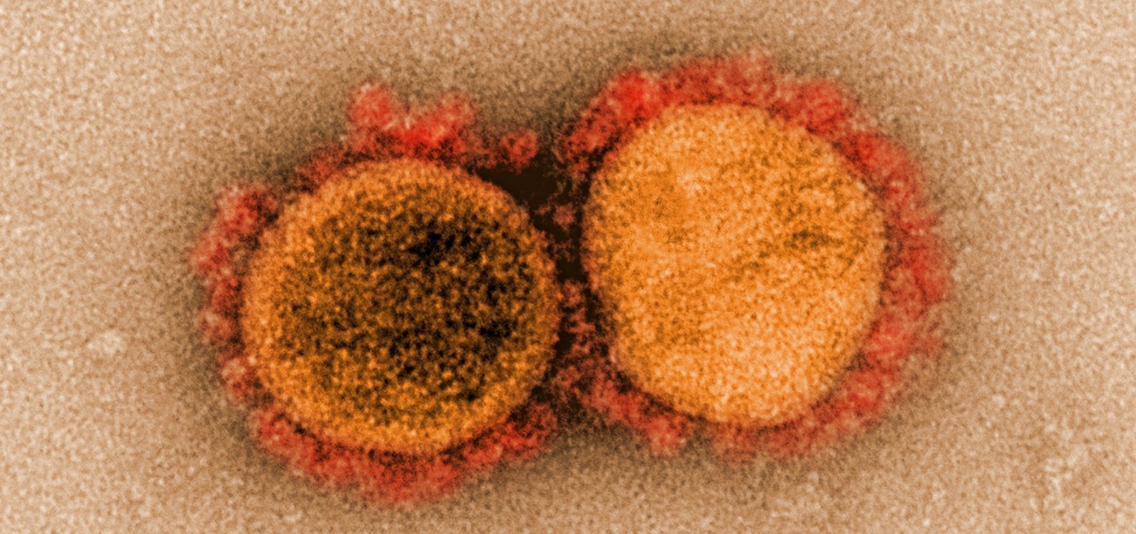 Sergipe registra primeiras mortes por coronavírus