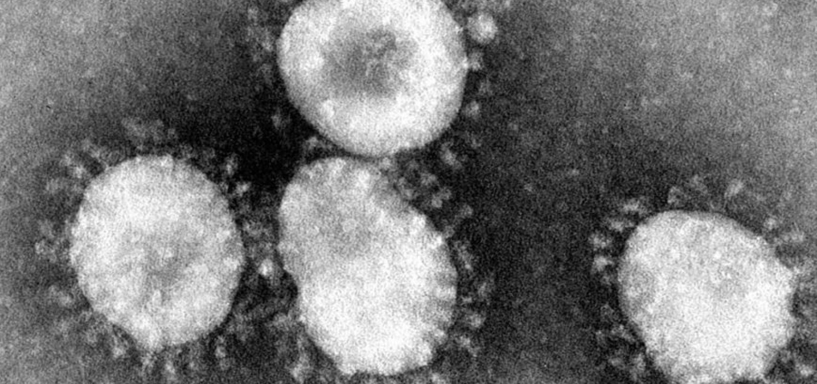 Bahia registra 282 casos confirmados do novo coronavírus 