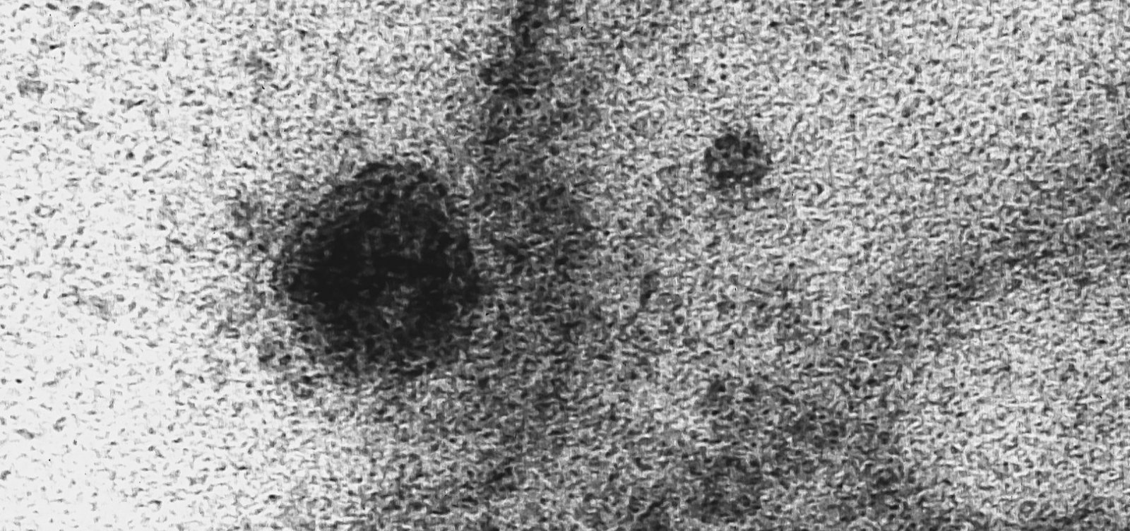 Registros inéditos mostram infecção do novo coronavírus em célula